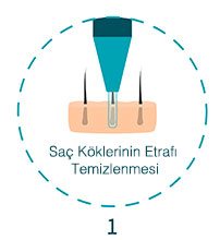 birinci aşama köklerin hazırlanması